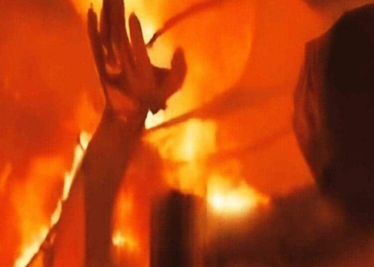 Israel’s blockade of gaza and effects of the occupation. Here, a young man burning alive in gaza