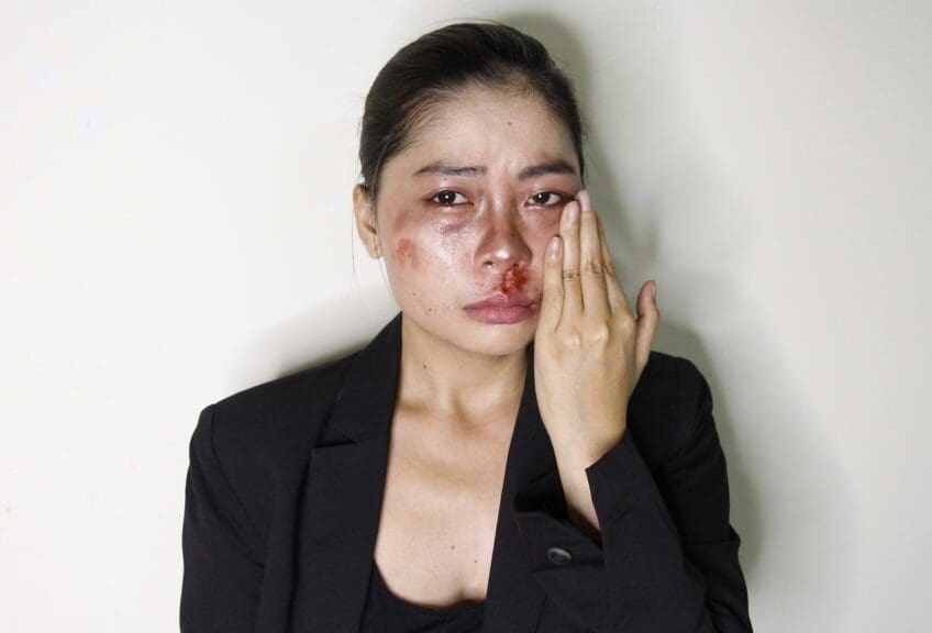 Victim of domestic violence, Asian woman with bruises and blood on her face