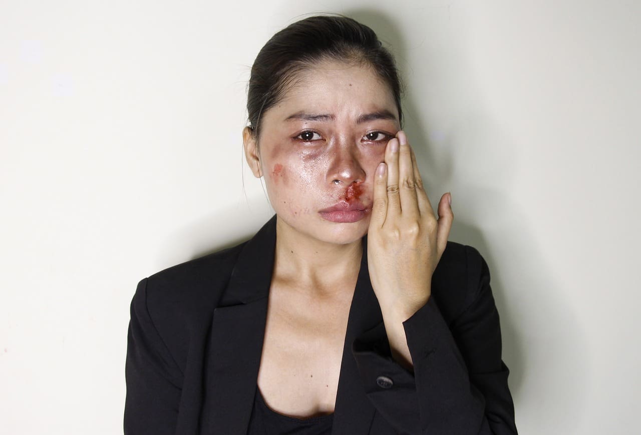 Victim of domestic violence, asian woman with bruises and blood on her face