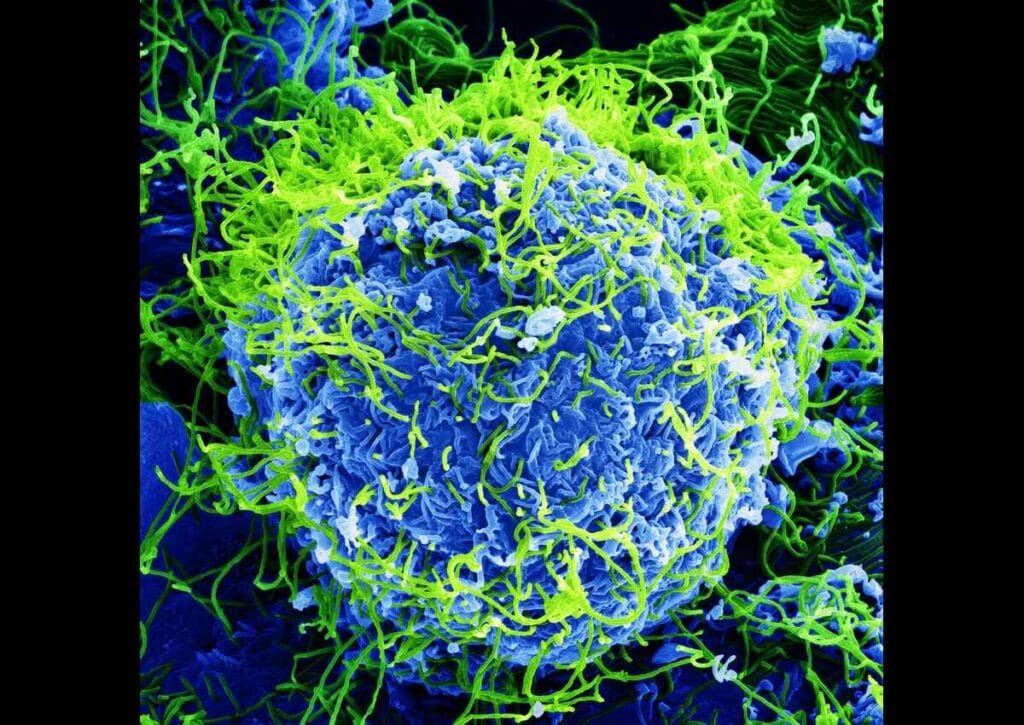 Magnified view of the Ebola virus. Cuts to usaid and the cdc