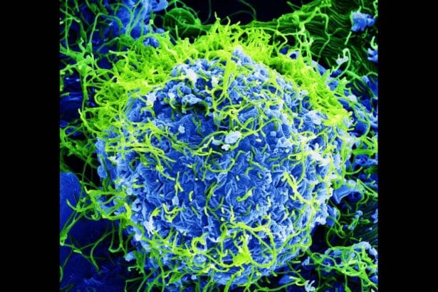 Magnified view of the Ebola virus